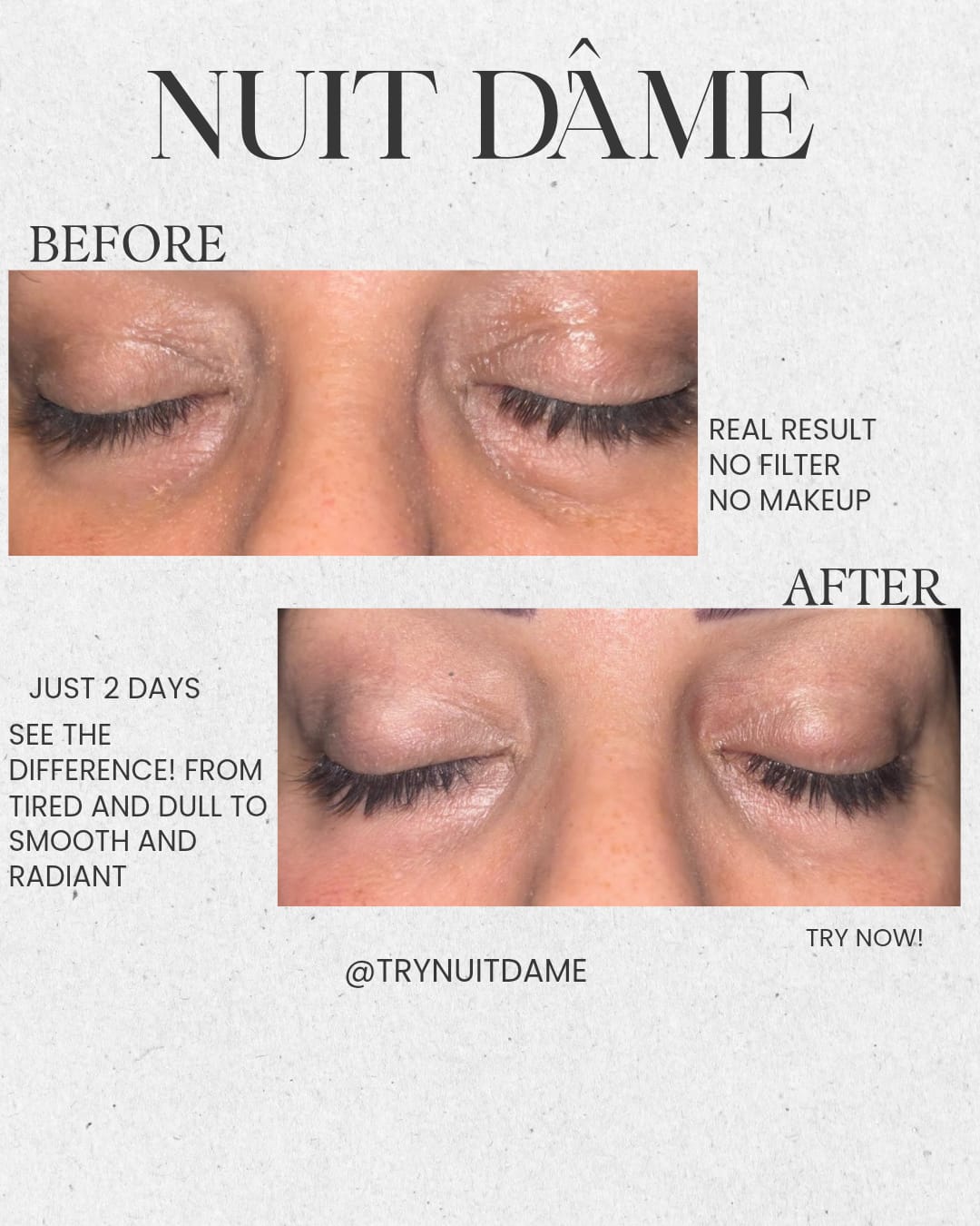 7 Pairs of Under-Eye Patches